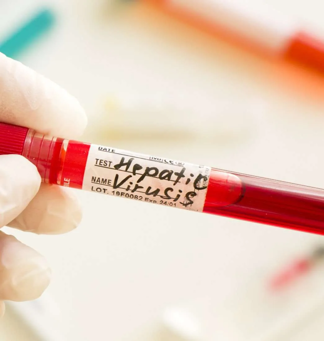 Infectious Diseases at WellHealth Medical Associates in Rochester Hills, MI